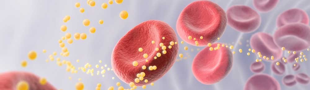 7 Disadvantages of Bad Cholesterol